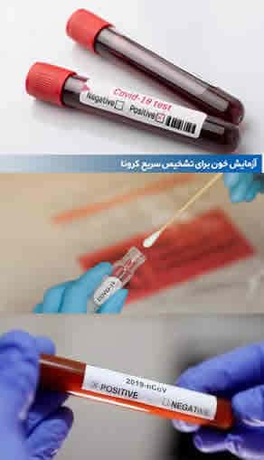 آزمایش کرونا